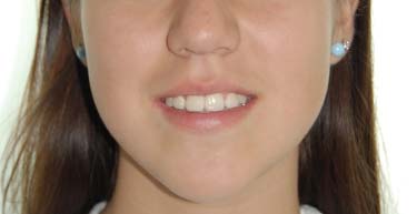 Casos: Ortodoncial